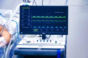 Ventilador mecánico ASMAR-UdeC supera pruebas clínicas y se alista para su fabricación Ventilador mecánico ASMAR-UdeC supera pruebas clínicas y se alista para su fabricación